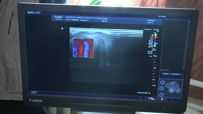У Франківських поліклініках встановили три нові УЗД апарати У Франківських поліклініках встановили три нові УЗД апарати
