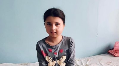 У Львові хірурги прооперували 11-річну дівчинку, у якої майже не відкривався рот