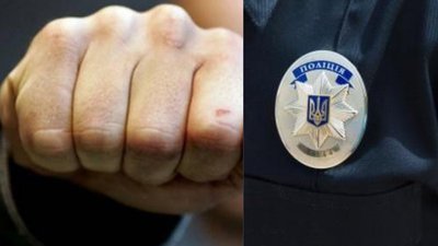 "Перелом кісток". На Сумщині пішохід потрапив до лікарні внаслідок сварки з водієм