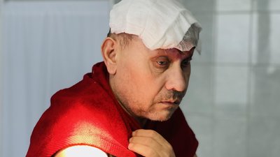 Переніс 30 операцій. Історія 55-річного Михайла з Херсонщини Переніс 30 операцій. Історія 55-річного Михайла з Херсонщини