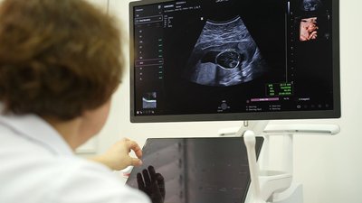 У черкаському перинатальному центрі встановили високоточний УЗД-апарат