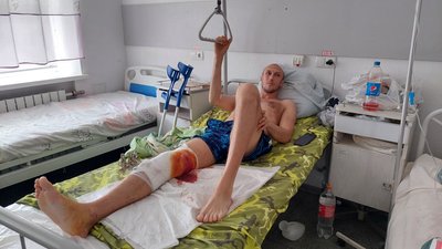 "Мене перекинуло в повітрі". Як проходить лікування поранених внаслідок обстрілів Харківщини "Мене перекинуло в повітрі". Як проходить лікування поранених внаслідок обстрілів Харківщини
