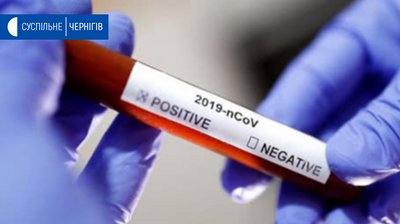 У Чернігова з’явиться власна лабораторія для діагностування коронавірусу