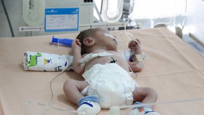 "Важко дивитися, коли задихається вагітна". Як працює ковідне відділення перинатального центру Одеси