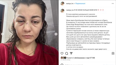 Побив дружину на очах у сина: в Одесі поліція відкрила кримінальне провадження Побив дружину на очах у сина: в Одесі поліція відкрила кримінальне провадження