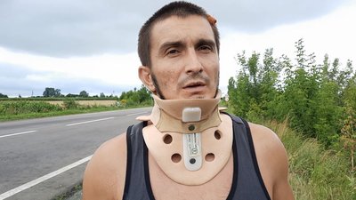 Розповіли про стан травмованих в аварії на трасі Луцьк–Горохів Розповіли про стан травмованих в аварії на трасі Луцьк–Горохів
