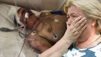 Вибухнуло колесо тролейбуса у Чернігові: чоловік, який ремонтував, в реанімації
