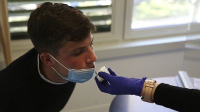 Від чого ще окрім коронавірусу можна втратити нюх Від чого ще окрім коронавірусу можна втратити нюх
