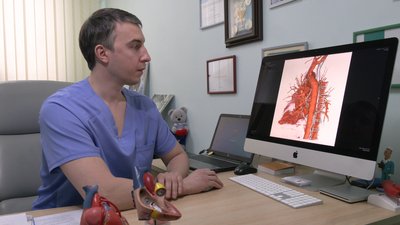 Одна з найскладніших патологій: у черкаському кардіоцентрі пацієнт серцево-судинної хірургії отримав шанс на друге життя Одна з найскладніших патологій: у черкаському кардіоцентрі пацієнт серцево-судинної хірургії отримав шанс на друге життя