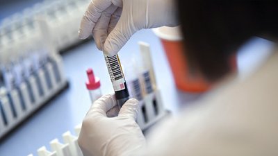 На Закарпатті виявлено 13 нових випадків коронавірусу