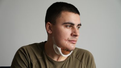 Андрій Грушко, пацієнт центру "Незламні" Андрій Грушко, пацієнт центру "Незламні"