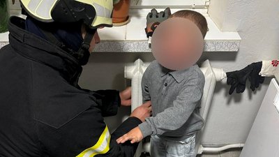 дитина застрягла у батареї в Луцьку, затисло руку дитини у батареї