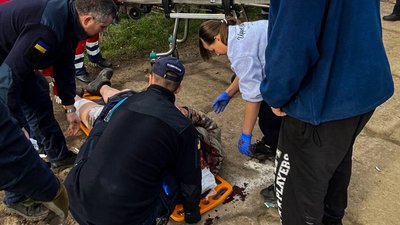 На Миколаївщині сталася ДТП: є травмовані На Миколаївщині сталася ДТП: є травмовані