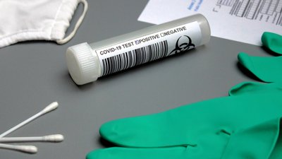 COVID-19: на Херсонщині за добу виявили 7 випадків захворювання