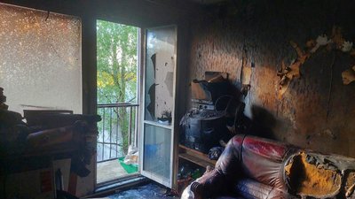 В Ужгороді під час пожежі травмувався чоловік