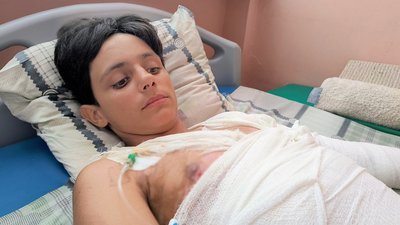 14-річний Ілля під час лікування