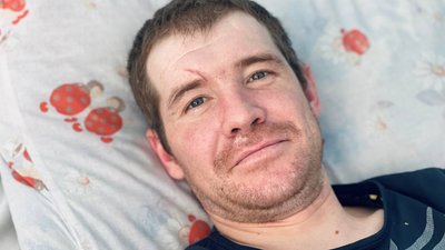 У Львові лікують донеччанина, який отримав опіки, рятуючи людей