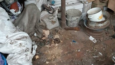 На Сумщині чоловік потрапив у лікарню внаслідок вибуху невідомого предмета