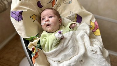 Львівські медики врятували немовля з кашлюком та двобічною пневмонією