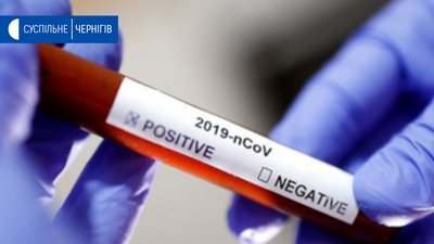 Ломако сказав, що Чернігів закупить 50 тестів на коронавірус