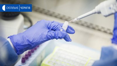 На Чернігівщині за добу виявили коронавірус у трьох людей