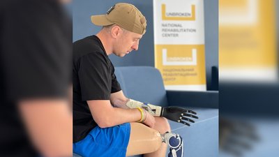 Чоловікові встановили протези ноги та руки Чоловікові встановили протези ноги та руки