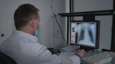 У Дніпрі пройшли акції до дня боротьби з туберкульозом