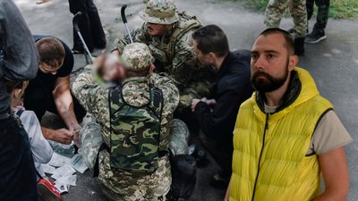 Втратив зір на одне око: що відомо про дворічного хлопчика, який травмувався внаслідок вистрілу РПГ у Чернігові