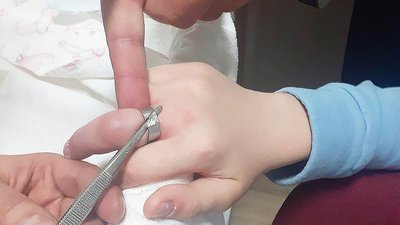 У Львові рятувальники зняли каблучку з пальця дитини за допомогою обладнання У Львові рятувальники зняли каблучку з пальця дитини за допомогою обладнання