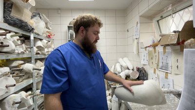 Протези для військових: як їх виготовляють на Рівненщині Протези для військових: як їх виготовляють на Рівненщині