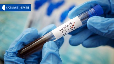 35 випадків коронавірусу на Чернігівщині