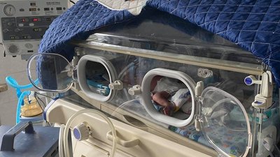 В івано-франківській лікарні врятували життя півторамісячному немовляті з COVID-19 В івано-франківській лікарні врятували життя півторамісячному немовляті з COVID-19