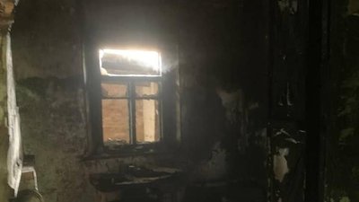 На Вінниччині внаслідок пожежі травмувалися дві людини