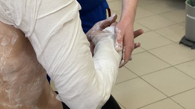 Вивихи, переломи та поранення: де у Дніпрі працюють травмпункти