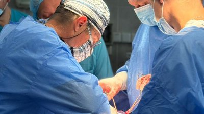 У полтавській лікарні під час операції у пацієнта виявили у бронху кутній зуб