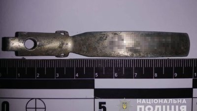 На Одещині підліток підірвався на невідомому предметі: він у реанімації На Одещині підліток підірвався на невідомому предметі: він у реанімації