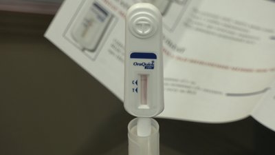 День боротьби зі СНІДом. Як і де отримати безкоштовний тест на ВІЛ дніпрянам