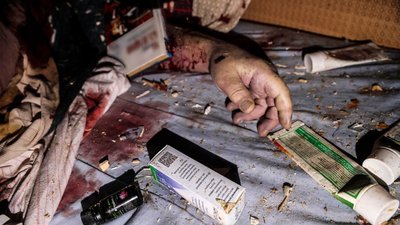 У Полтавській громаді кількість травмованих внаслідок атаки БпЛА зросла до чотирьох У Полтавській громаді кількість травмованих внаслідок атаки БпЛА зросла до чотирьох