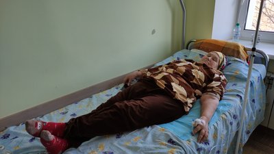 На Полтавщині не зростає кількість звернень до онкодиспансеру: яка причина