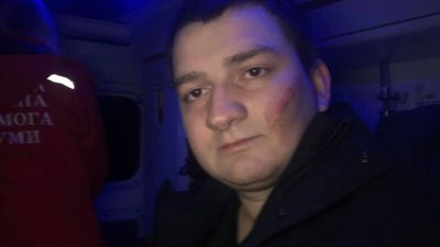 "Попередили замах". У СБУ кажуть, що побиття "слуги народу" було несправжнім