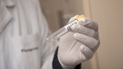 На Херсонщині за добу підтвердили 37 нових випадків захворювання на COVID-19