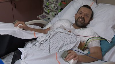 У Франції пацієнту вперше успішно пересадили обидві руки