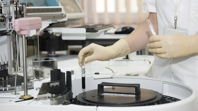 На Миколаївщині зафіксовано ще 12 хворих на COVID-19
