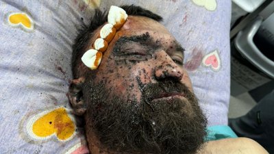 волонтер віталій колісник волонтер віталій колісник
