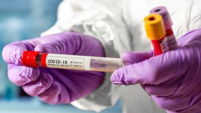 На Херсонщині зафіксували рекордні показники на COVID-19 - 1373 випадки за добу