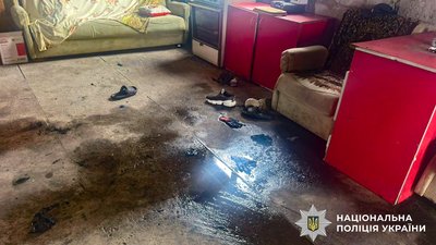 Через куріння під час заправки бензокоси були травмовані люди на Рівненщині