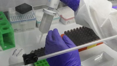 34 хворих на COVID-19 підтвердили в Ужгороді, з них 16 – медпрацівники
