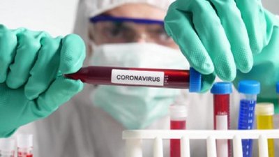 164 випадки захворювання на коронавірус виявили за добу на Полтавщині