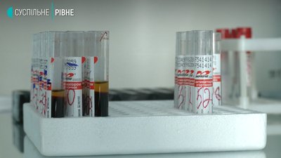 Коронавірус на Рівненщині: 53 нових хворих за добу, помер рівнянин