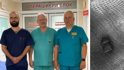 У лікарні в Рівному дістали пневматичну кулю з серця підлітка. Лікарі назвали операцію унікальною